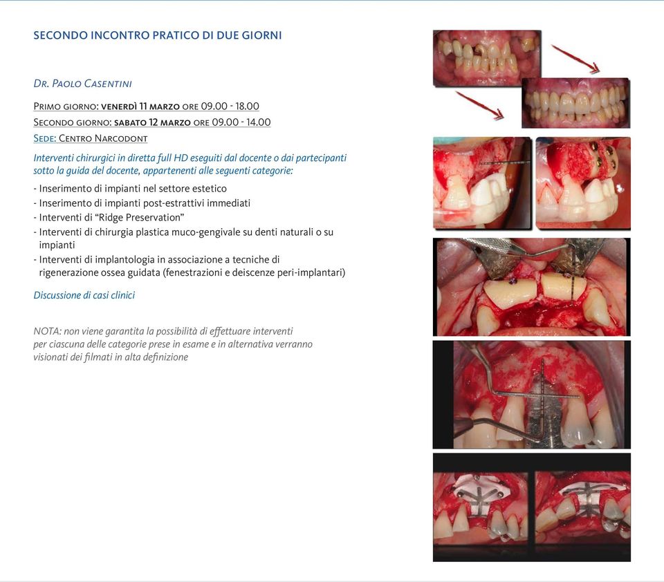 nel settore estetico - Inserimento di impianti post-estrattivi immediati - Interventi di Ridge Preservation - Interventi di chirurgia plastica muco-gengivale su denti naturali o su impianti -