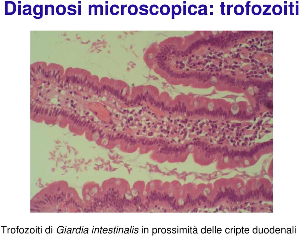 Giardia intestinalis in