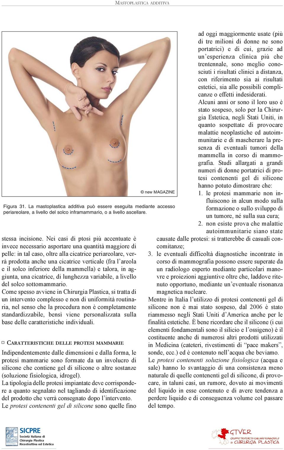 areola e il solco inferiore della mammella) e talora, in aggiunta, una cicatrice, di lunghezza variabile, a livello del solco sottomammario.