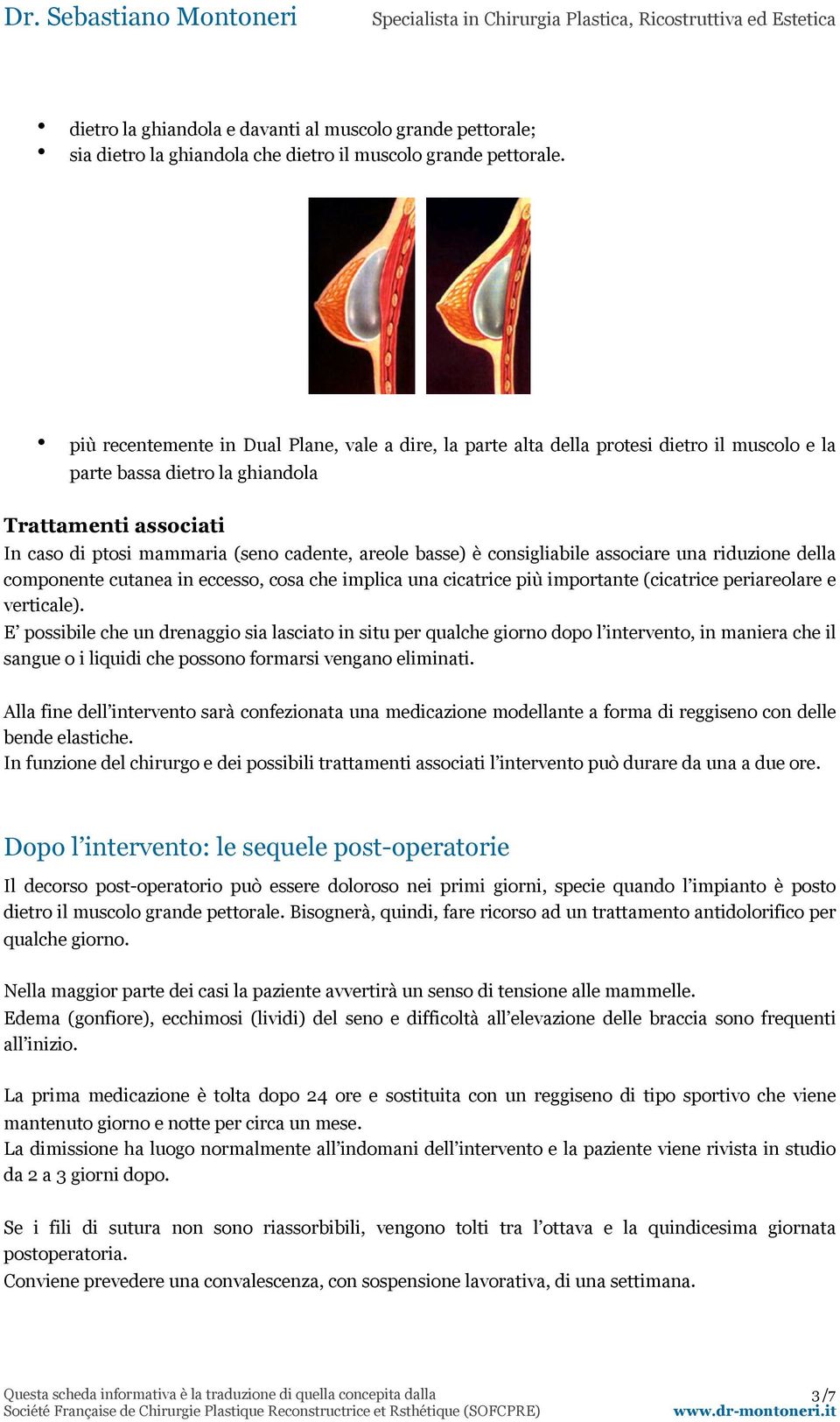 basse) è consigliabile associare una riduzione della componente cutanea in eccesso, cosa che implica una cicatrice più importante (cicatrice periareolare e verticale).