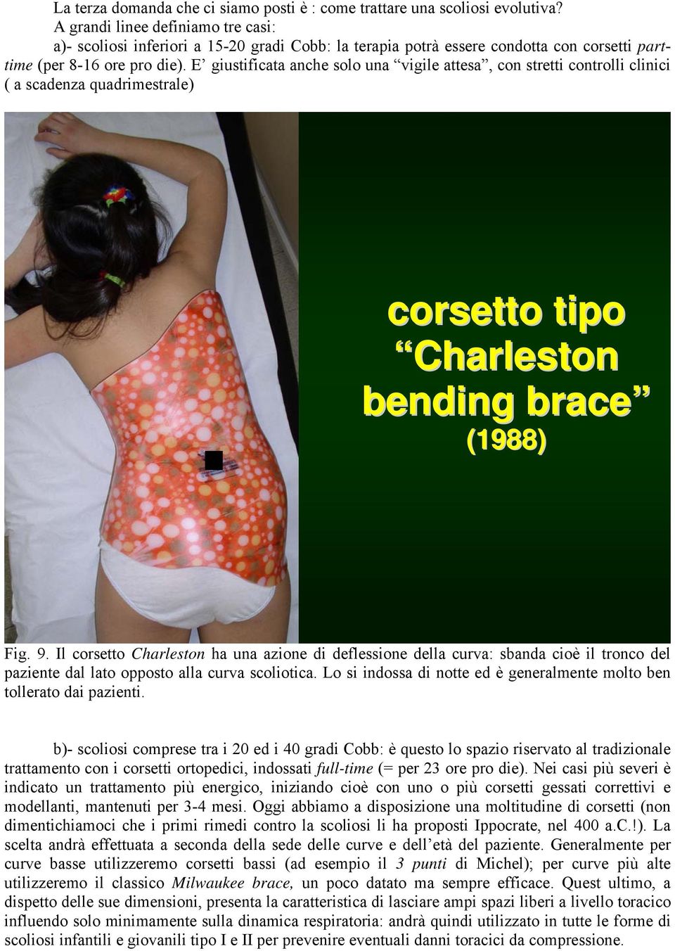 E giustificata anche solo una vigile attesa, con stretti controlli clinici ( a scadenza quadrimestrale) corsetto tipo Charleston bending brace (1988) Fig. 9.
