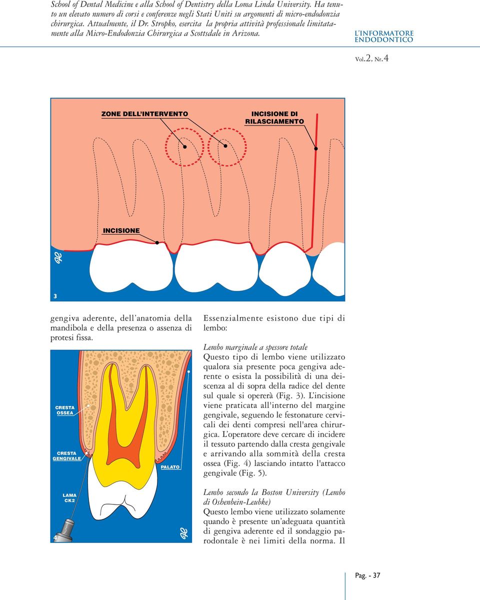 4 ZONE DELL INTERVENTO INCISIONE DI RILASCIAMENTO INCISIONE 3 gengiva aderente, dell anatomia della mandibola e della presenza o assenza di protesi fissa.