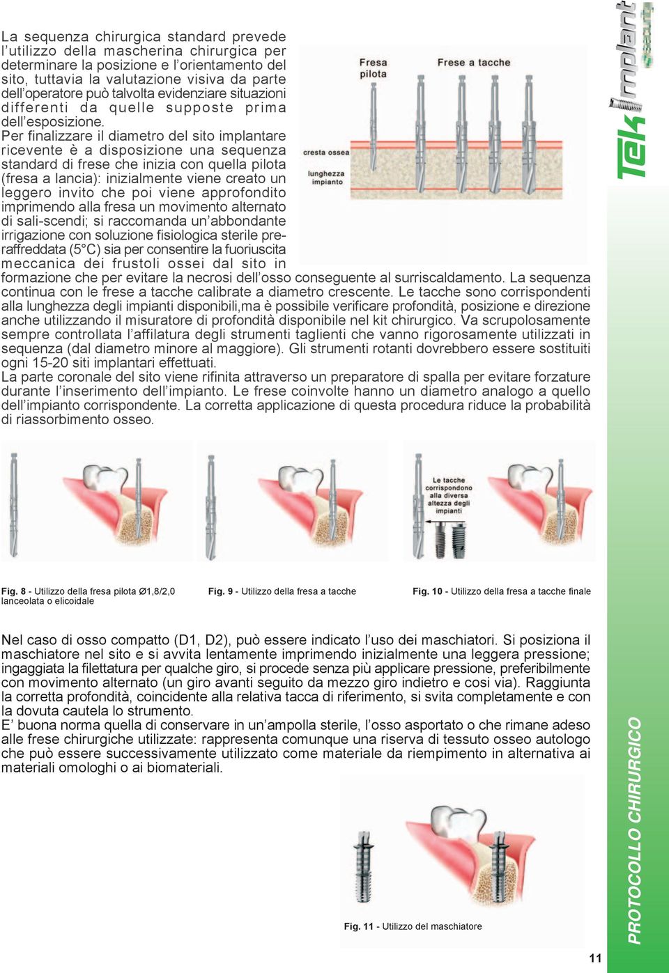 Per finalizzare il diametro del sito implantare ricevente è a disposizione una sequenza standard di frese che inizia con quella pilota (fresa a lancia): inizialmente viene creato un leggero invito