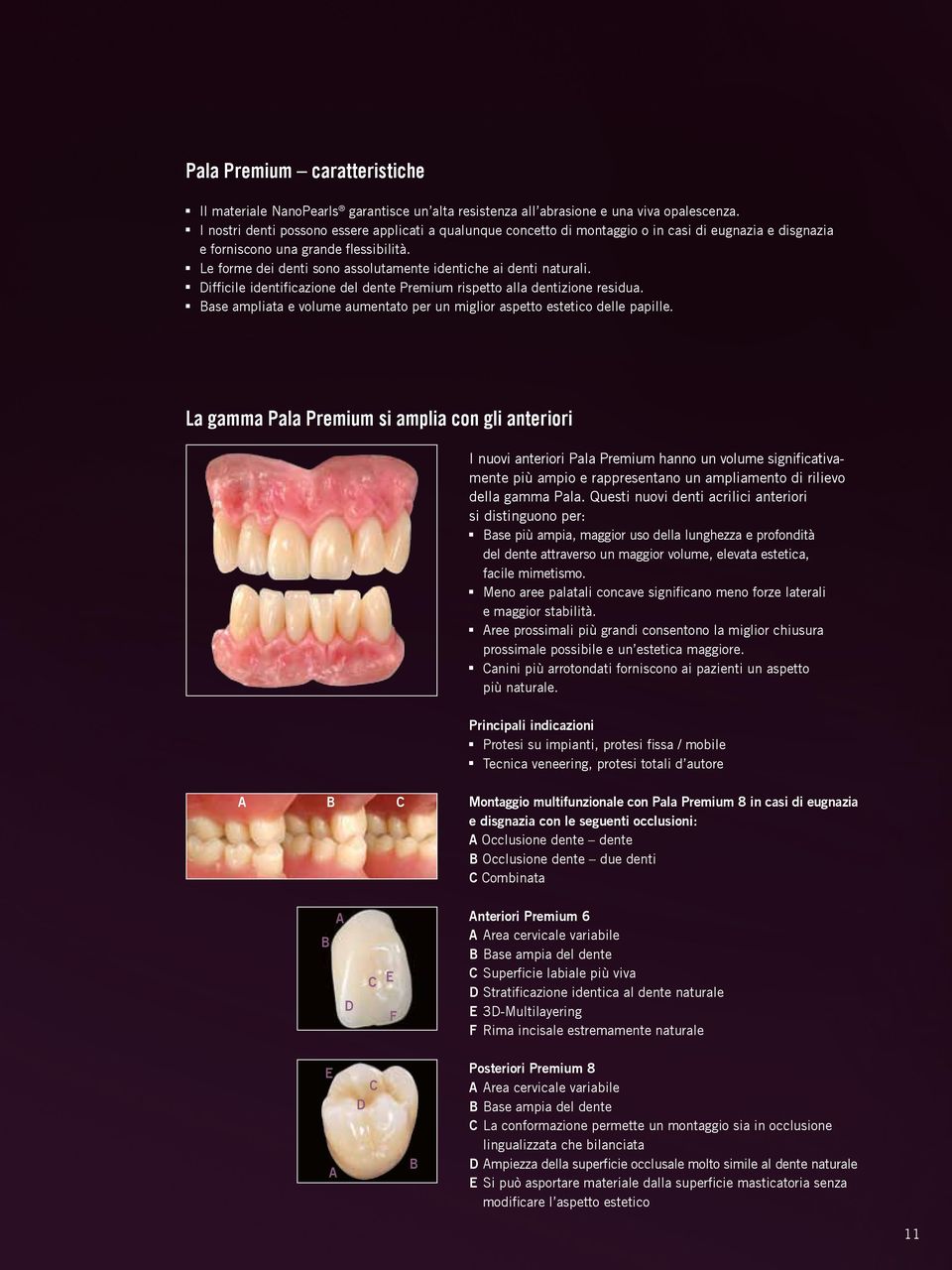 Le forme dei denti sono assolutamente identiche ai denti naturali. Difficile identificazione del dente Premium rispetto alla dentizione residua.