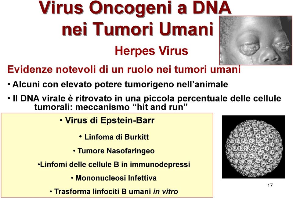 delle cellule tumorali: meccanismo hit and run Virus di Epstein-Barr Linfoma di Burkitt Tumore