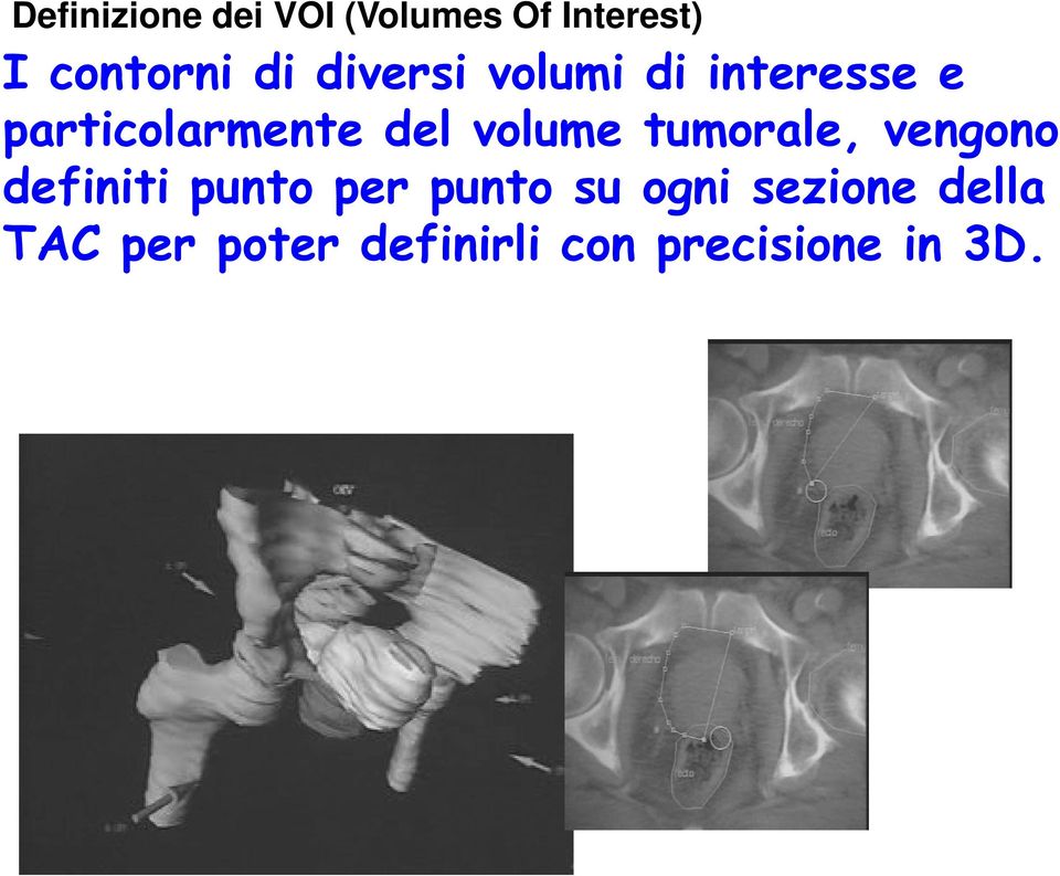 volume tumorale, vengono definiti punto per punto su