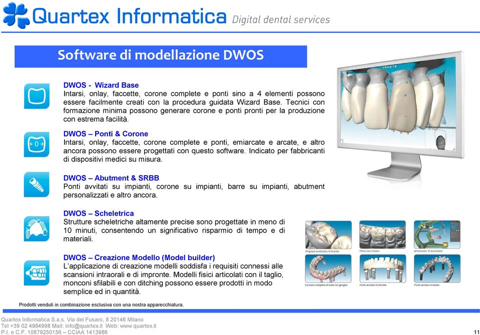 DWOS Ponti & Corone Intarsi, onlay, faccette, corone complete e ponti, emiarcate e arcate, e altro ancora possono essere progettati con questo software.