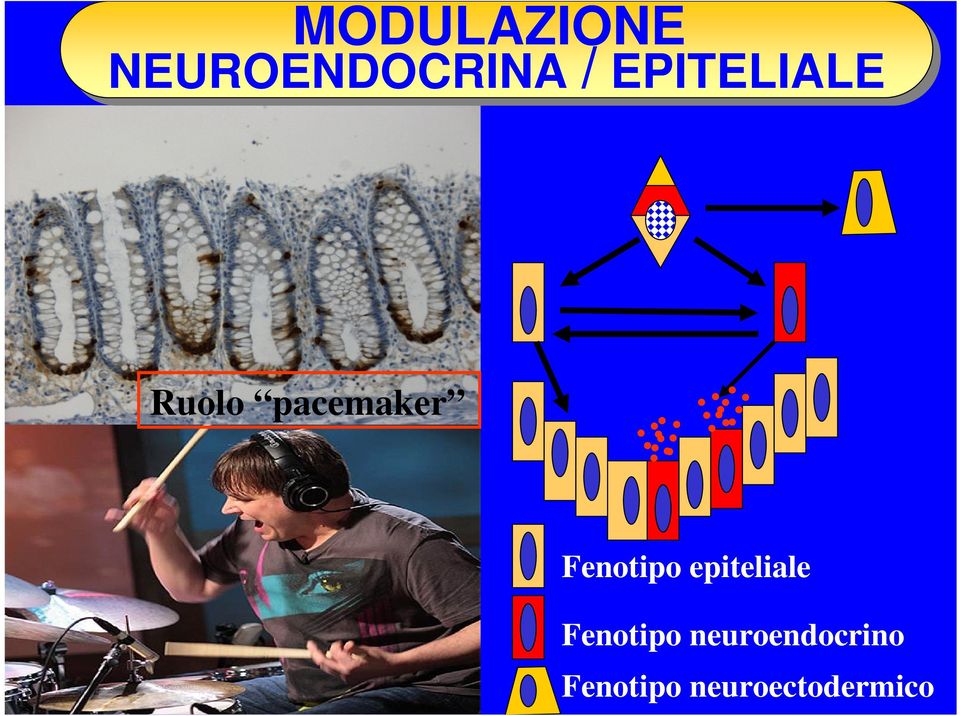 Fenotipo epiteliale Fenotipo