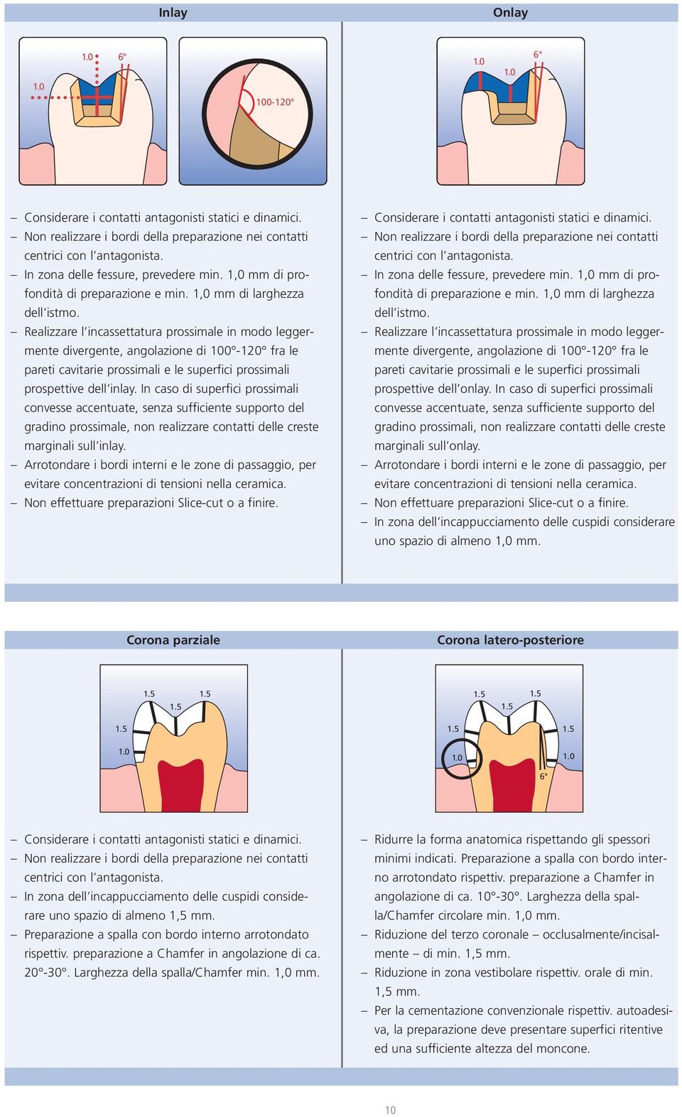 Realizzare l incassettatura prossimale in modo leggermente divergente, angolazione di 100-120 fra le pareti cavitarie prossimali e le superfici prossimali prospettive dell inlay.