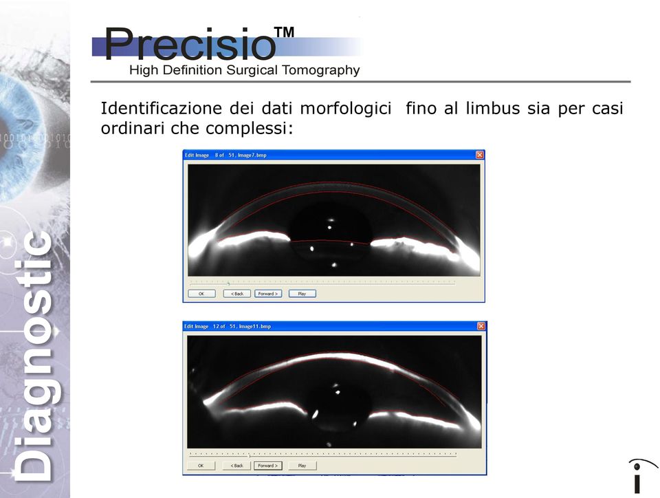 dati morfologici fino al limbus