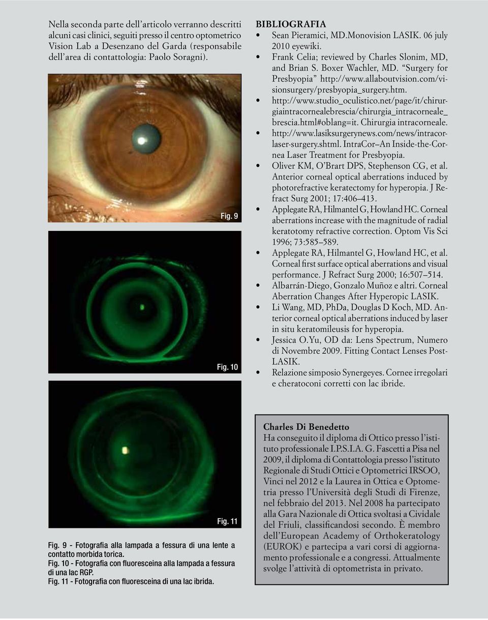 Surgery for Presbyopia http://www.allaboutvision.com/visionsurgery/presbyopia_surgery.htm. http://www.studio_oculistico.net/page/it/chirurgiaintracornealebrescia/chirurgia_intracorneale_ brescia.