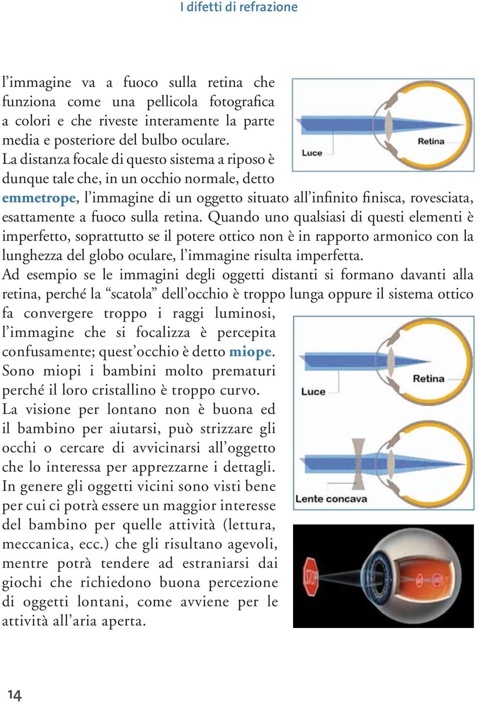 retina. Quando uno qualsiasi di questi elementi è imperfetto, soprattutto se il potere ottico non è in rapporto armonico con la lunghezza del globo oculare, l immagine risulta imperfetta.