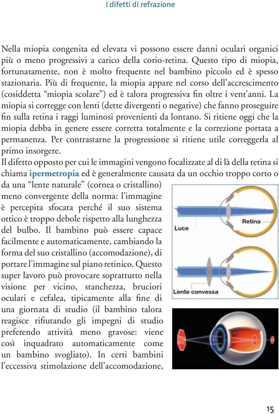 Più di frequente, la miopia appare nel corso dell accrescimento (cosiddetta miopia scolare ) ed è talora progressiva fin oltre i vent anni.