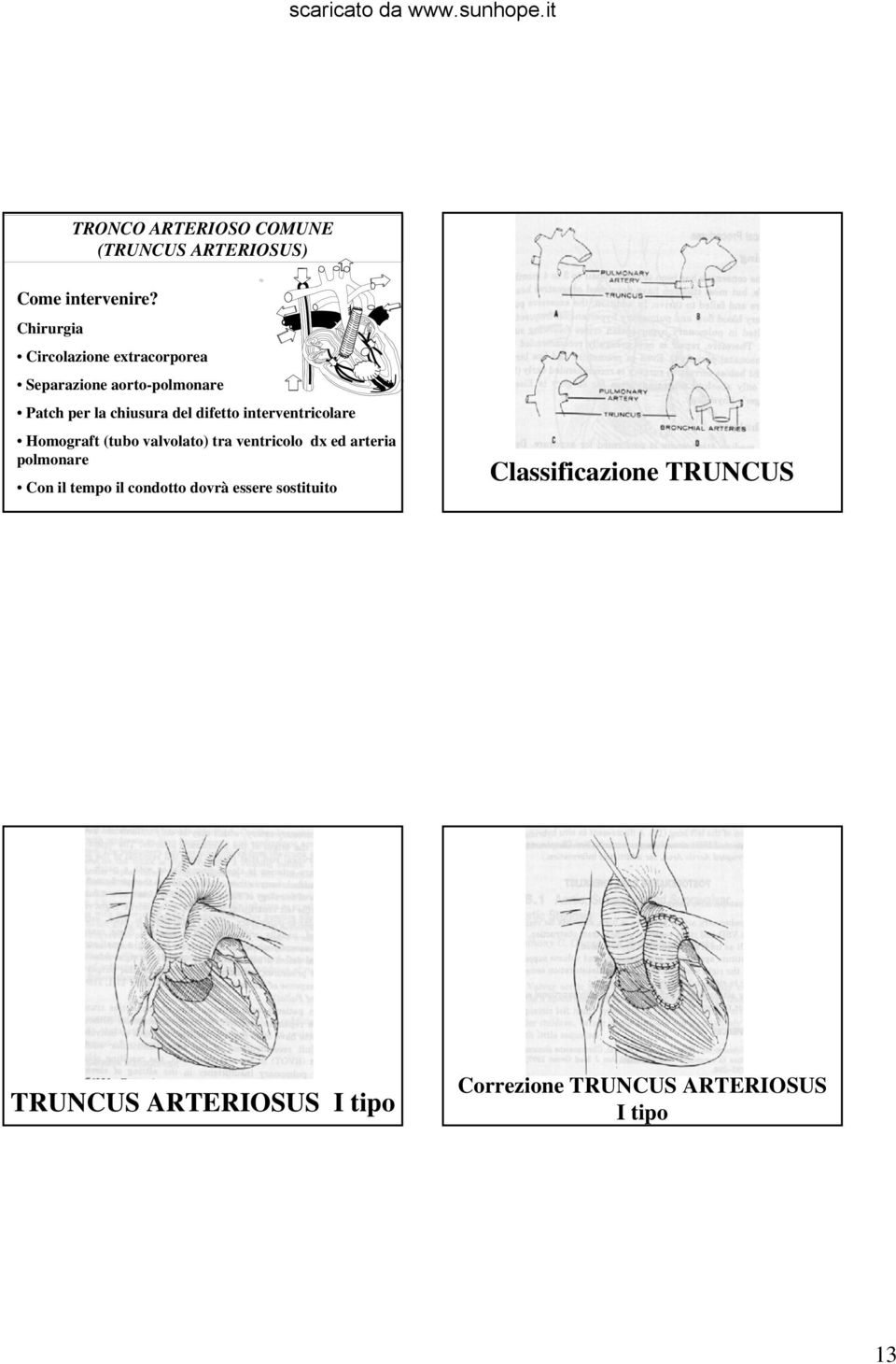 (tubo valvolato) tra ventricolo dx ed arteria polmonare Con il tempo il condotto dovrà