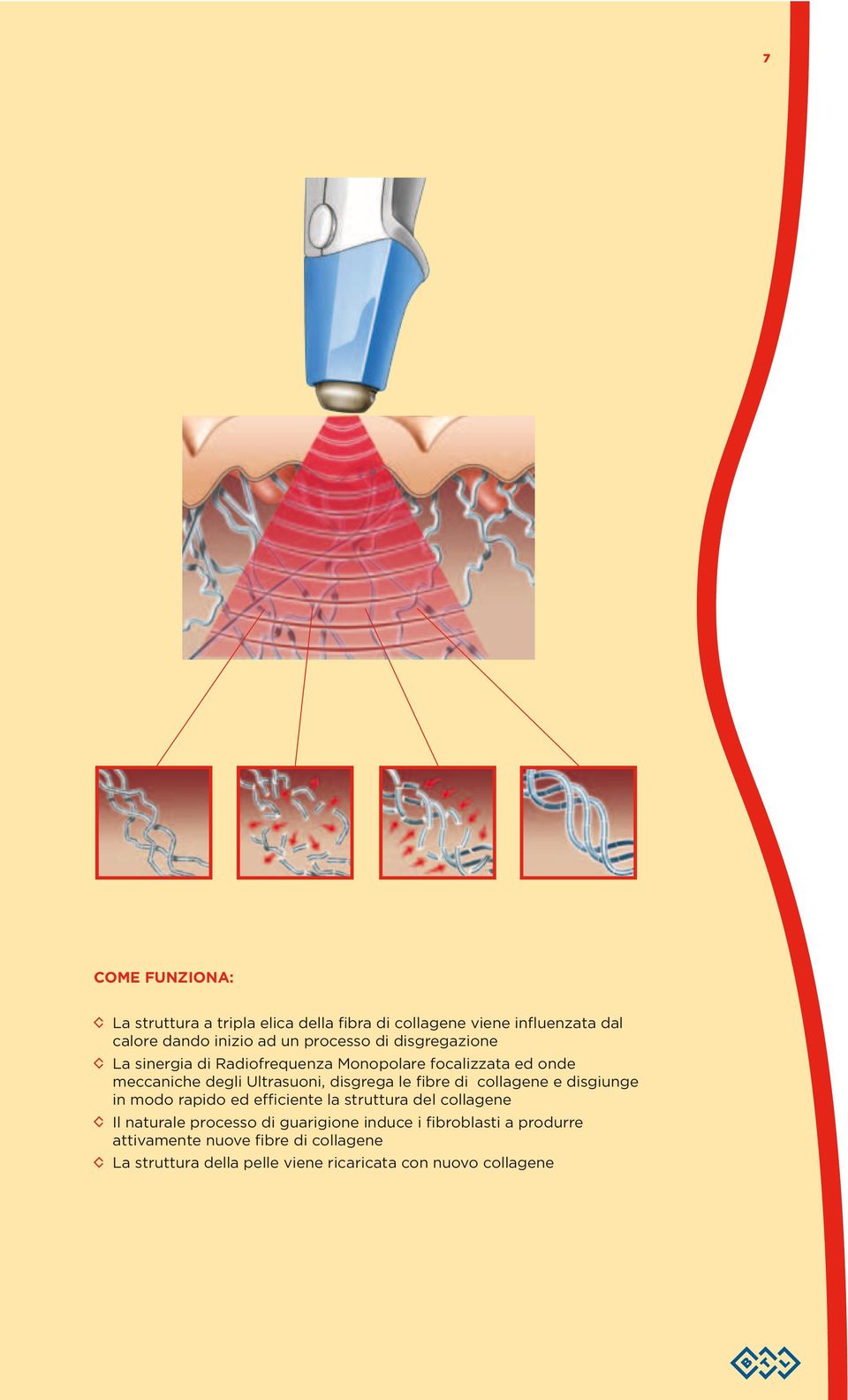 di collagene e disgiunge in modo rapido ed efficiente la struttura del collagene Il naturale processo di guarigione induce i