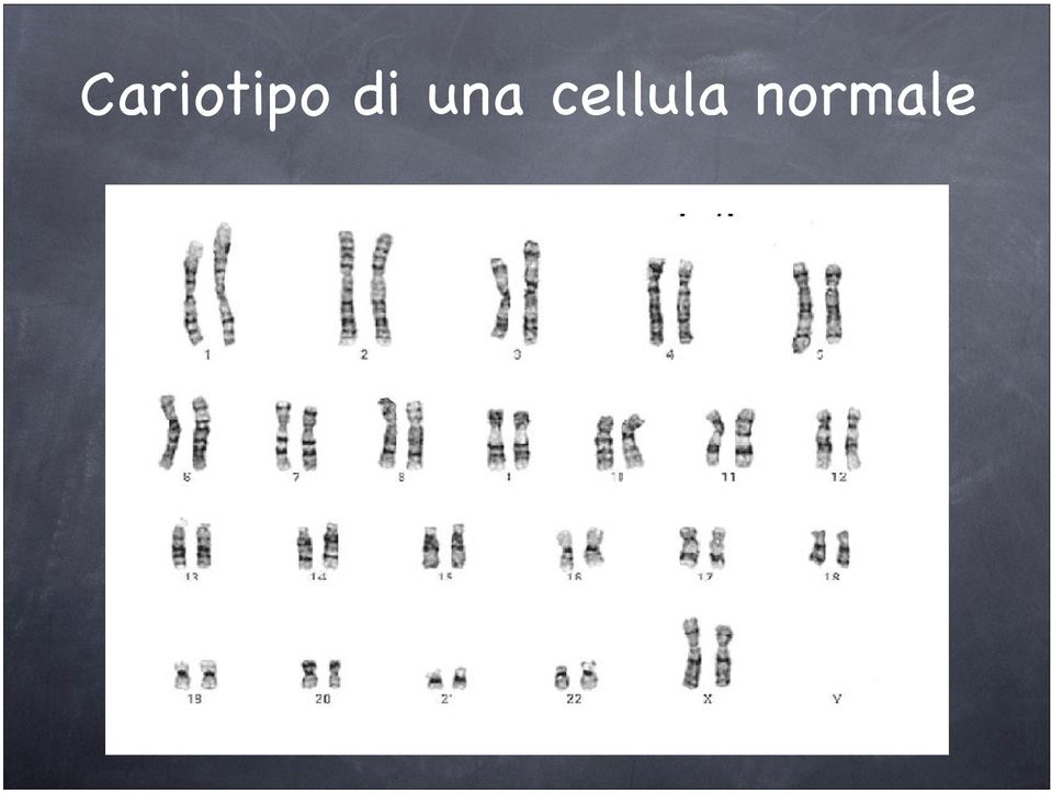 normale