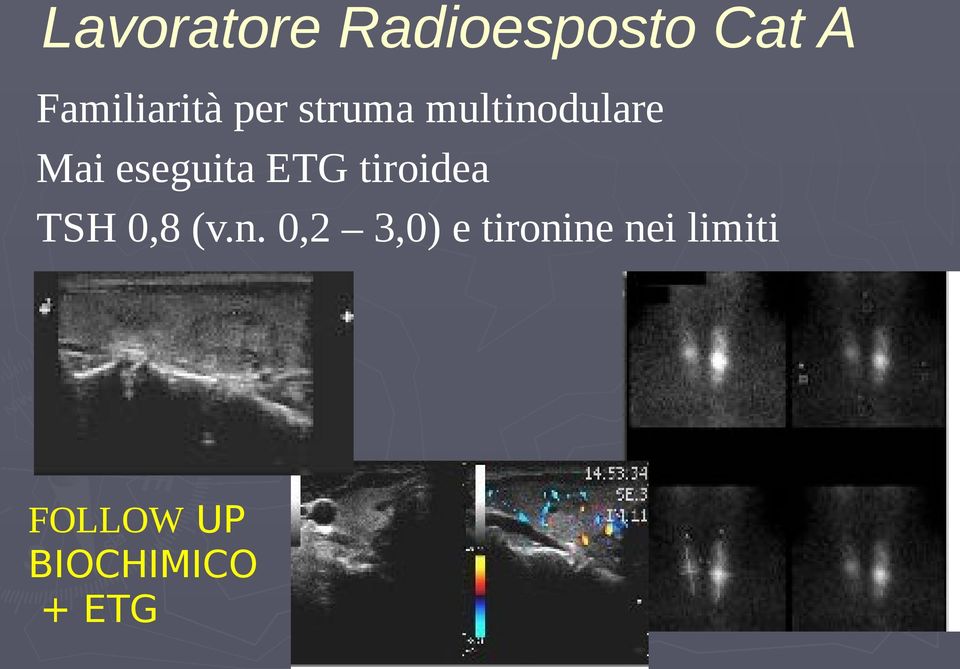 eseguita ETG tiroidea TSH 0,8 (v.n.