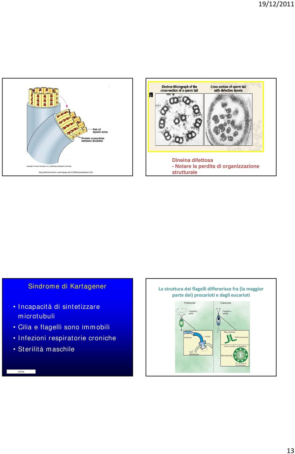 La struttura dei flagelli differerisce fra (la maggior parte dei) procarioti e degli eucarioti