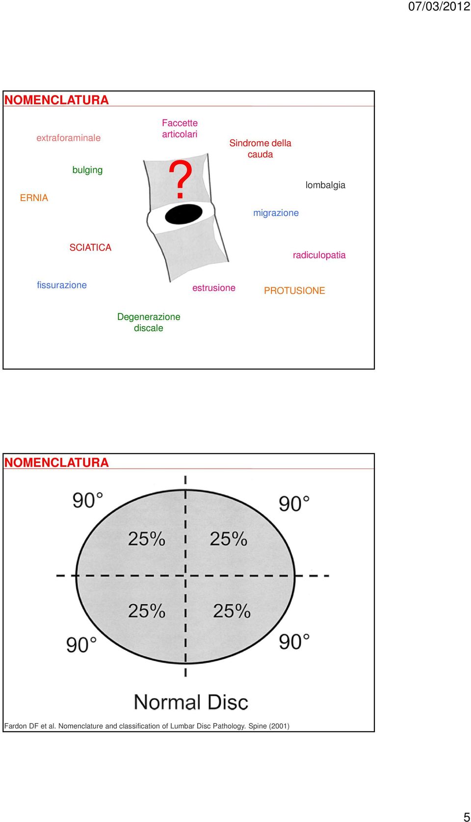 migrazione lombalgia SCIATICA radiculopatia fissurazione estrusione