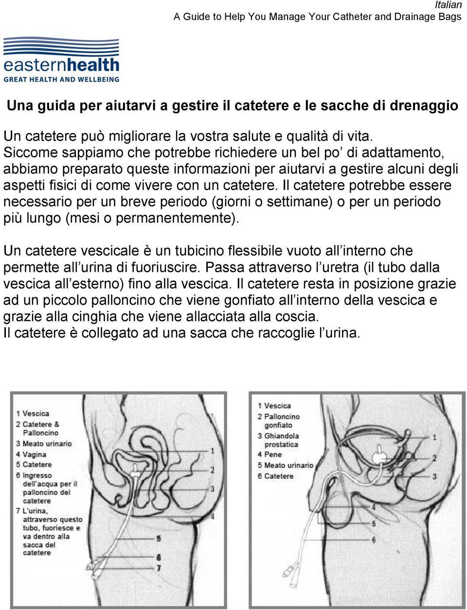 Il catetere potrebbe essere necessario per un breve periodo (giorni o settimane) o per un periodo più lungo (mesi o permanentemente).