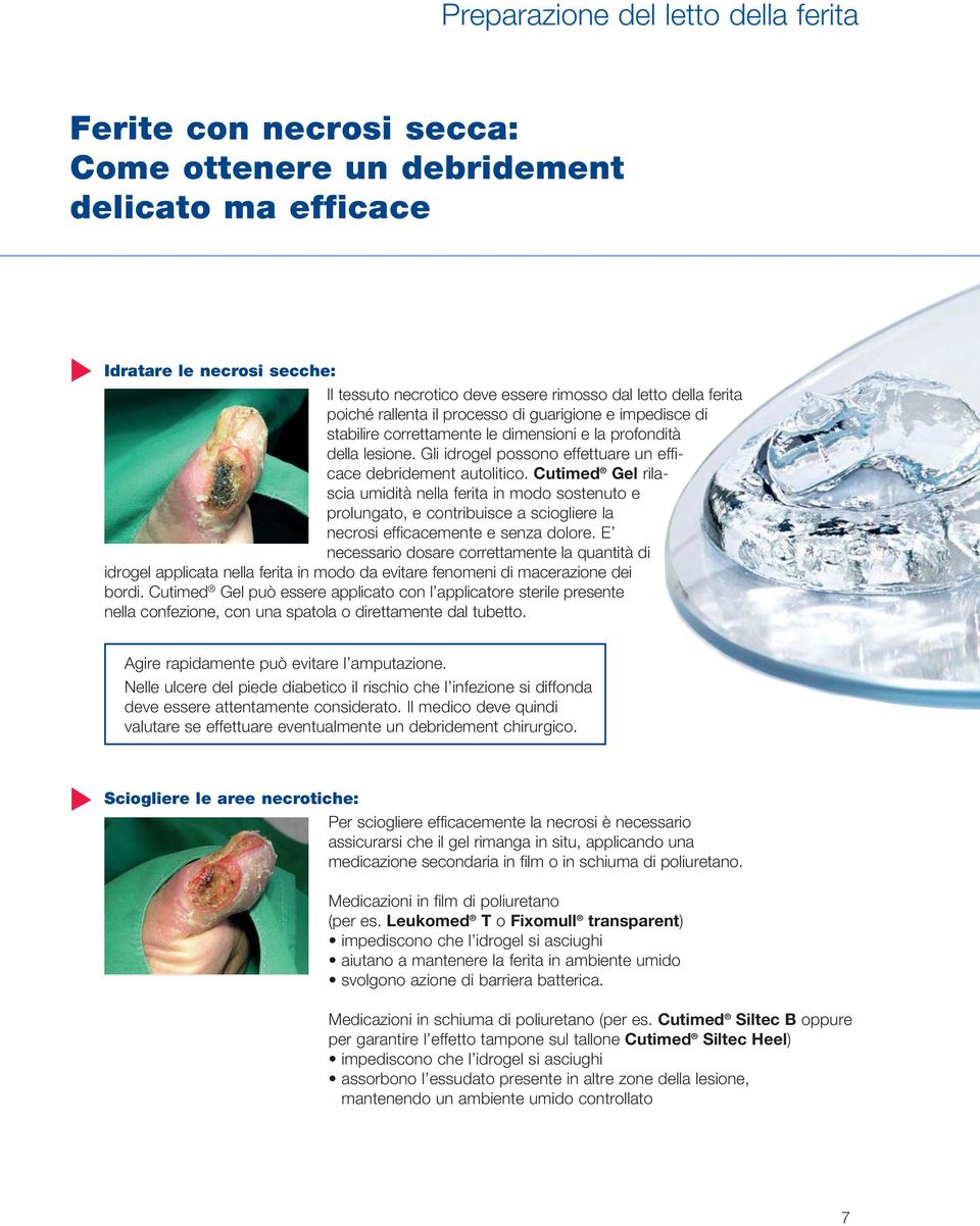 Cutimed Gel rilascia umidità nella ferita in modo sostenuto e prolungato, e contribuisce a sciogliere la necrosi efficacemente e senza dolore.