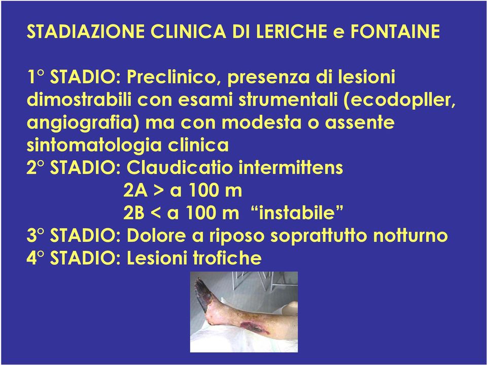 assente sintomatologia clinica 2 STADIO: Claudicatio intermittens 2A > a 100 m 2B <