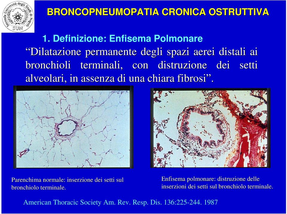 Parenchima normale: inserzione dei setti sul bronchiolo terminale.