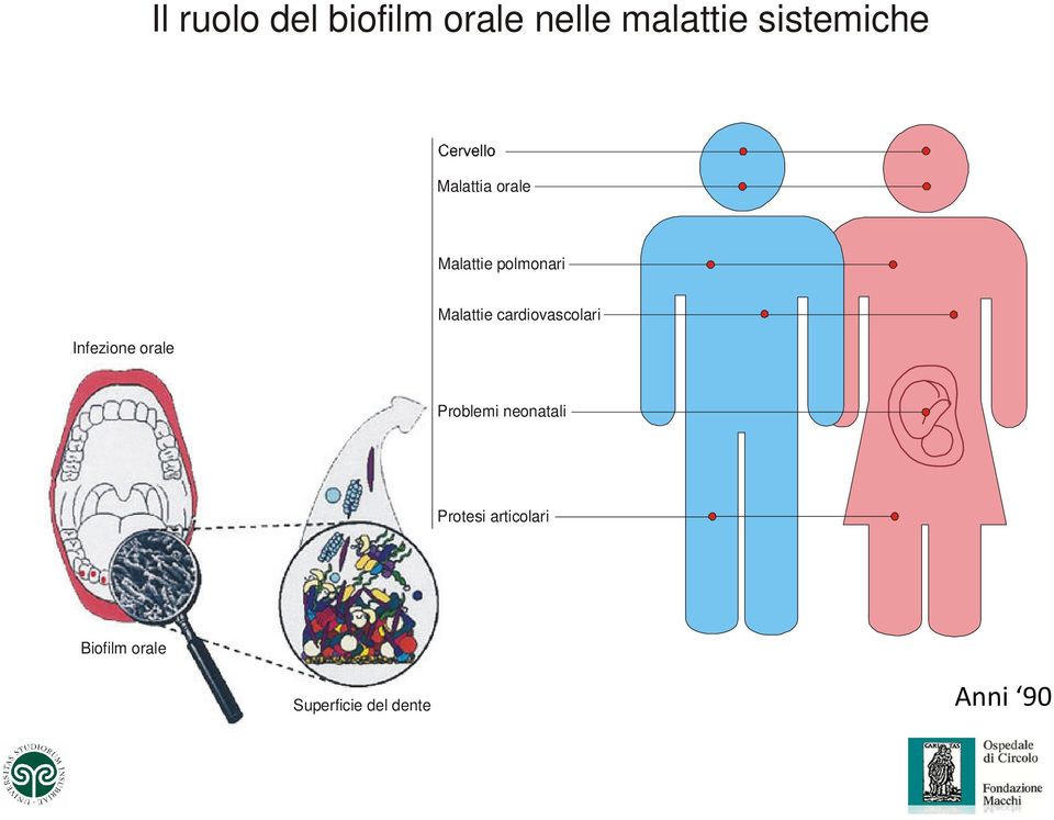 Infezione orale Malattie cardiovascolari Problemi