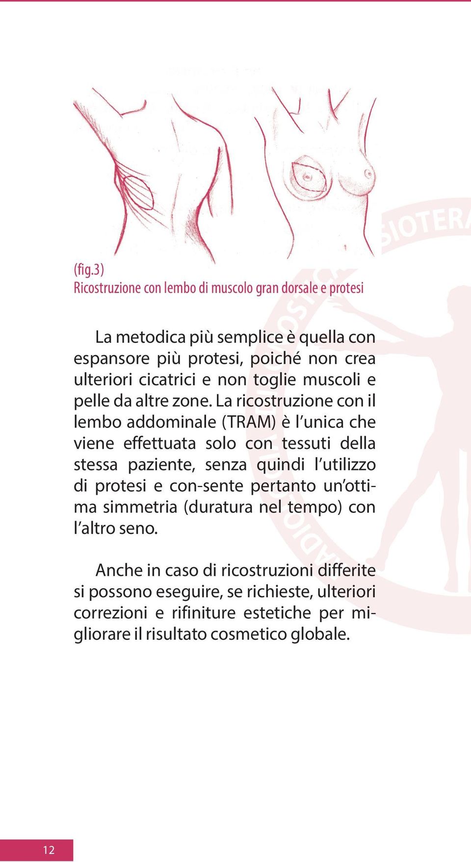 La ricostruzione con il lembo addominale (TRAM) è l unica che viene effettuata solo con tessuti della stessa paziente, senza quindi l utilizzo di