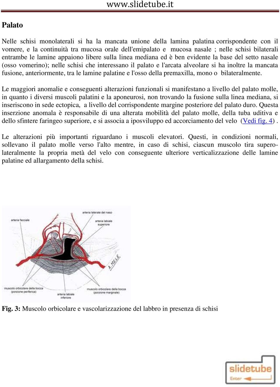 fusione, anteriormente, tra le lamine palatine e l'osso della premaxilla, mono o bilateralmente.