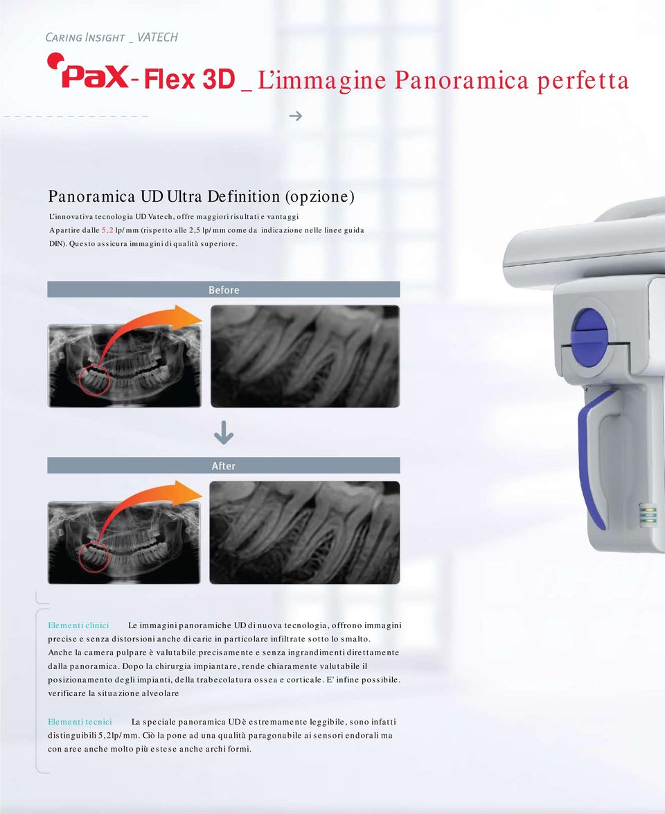 Elementi clinici Le immagini panoramiche UD di nuova tecnologia, offrono immagini precise e senza distorsioni anche di carie in particolare infiltrate sotto lo smalto.