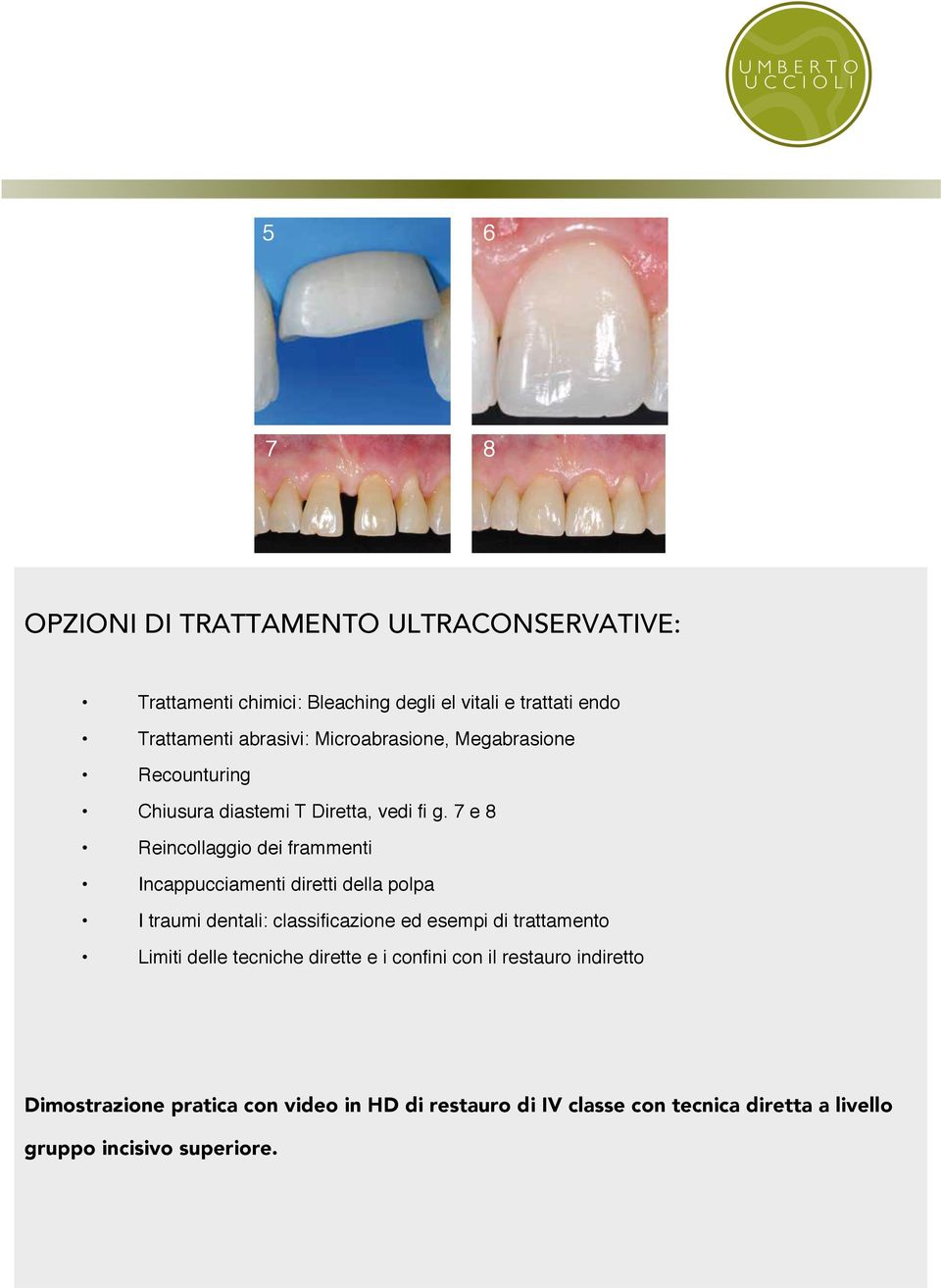 7 e 8 Reincollaggio dei frammenti Incappucciamenti diretti della polpa I traumi dentali: classificazione ed esempi di trattamento