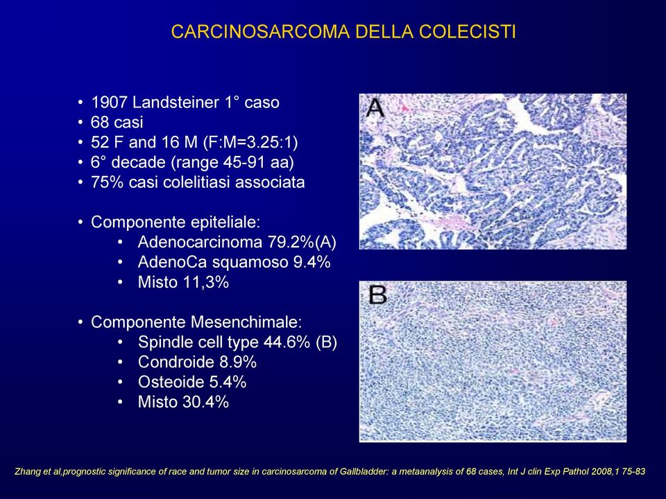 2%(A) AdenoCa squamoso 9.4% Misto 11,3% Componente Mesenchimale: Spindle cell type 44.6% (B) Condroide 8.9% Osteoide 5.