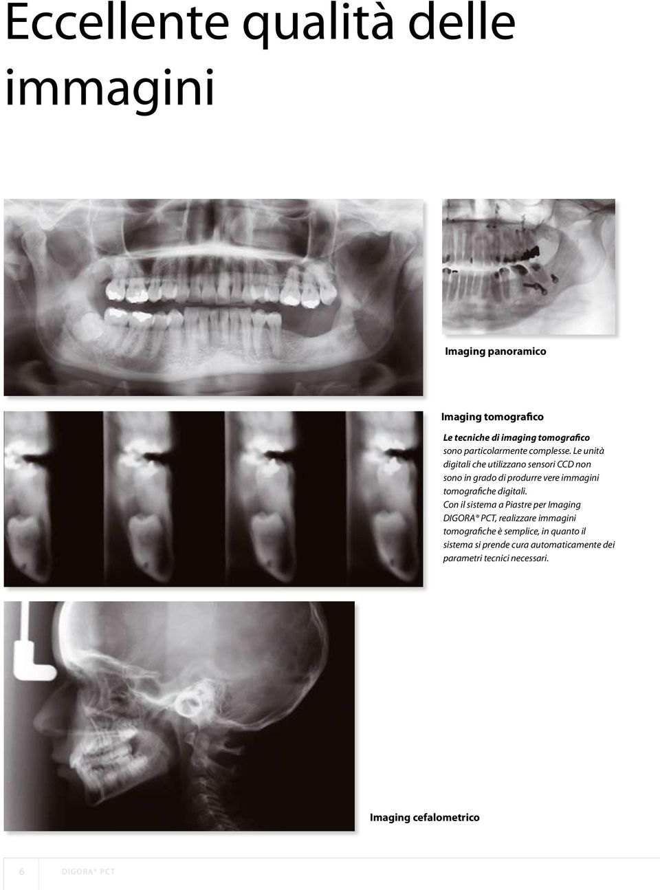 Le unità digitali che utilizzano sensori CCD non sono in grado di produrre vere immagini tomografiche digitali.