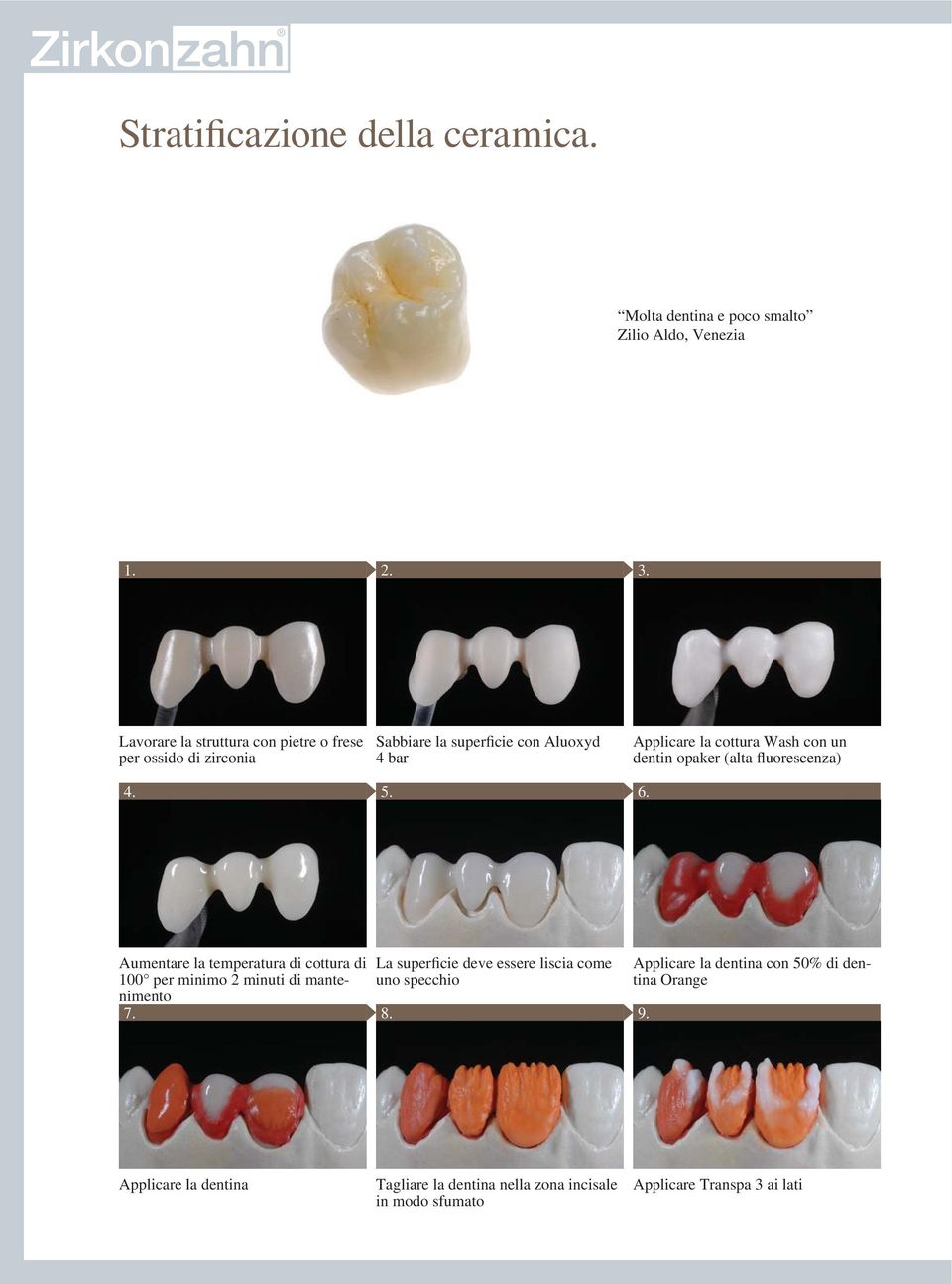 dentin opaker (alta fluorescenza) 4. 5. 6.