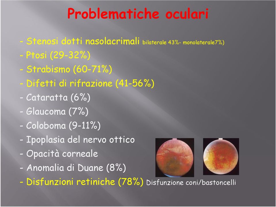 (6%) -Glaucoma(7%) - Coloboma (9-11%) - Ipoplasia del nervo ottico - Opacità