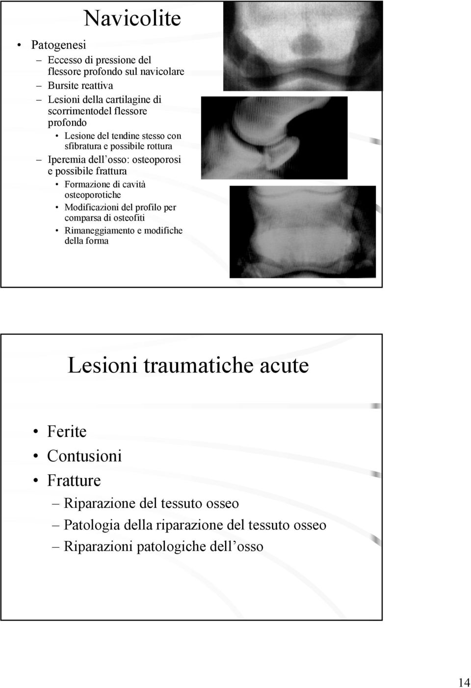 Formazione di cavità osteoporotiche Modificazioni del profilo per comparsa di osteofiti Rimaneggiamento e modifiche della forma Lesioni