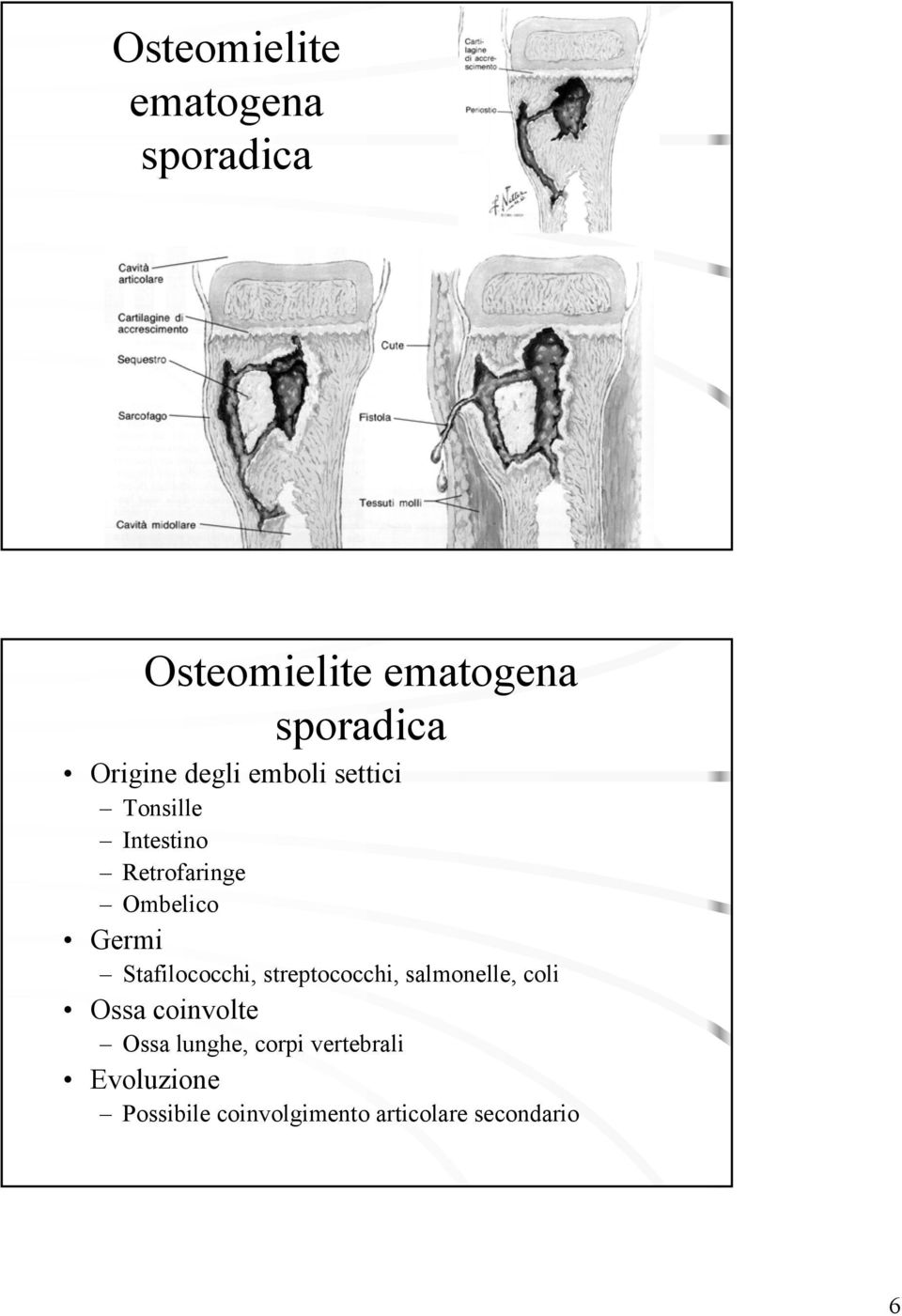 Stafilococchi, streptococchi, salmonelle, coli Ossa coinvolte Ossa