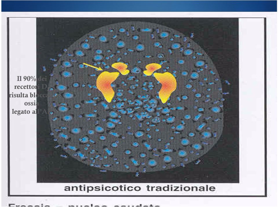 striato Il 90% dei recettori D 2