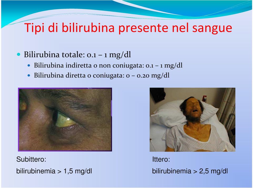 1 1 mg/dl Bilirubina diretta o coniugata: 0 0.