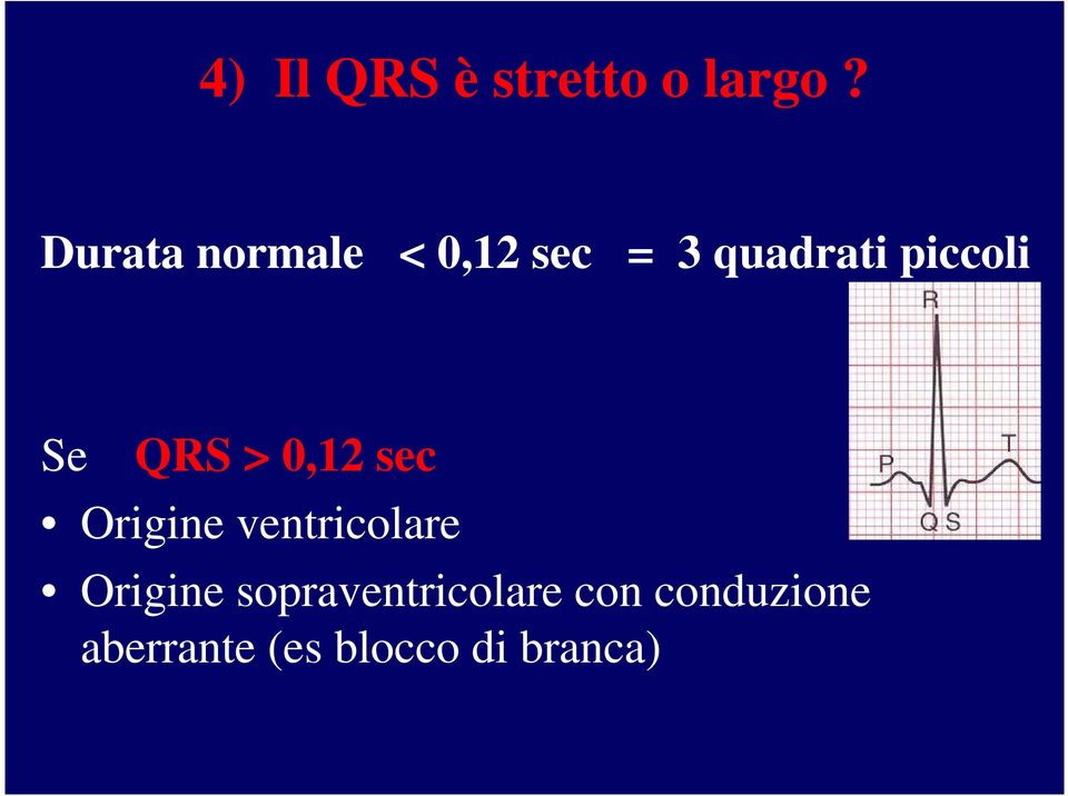 Se QRS > 0,12 sec Origine ventricolare Origine