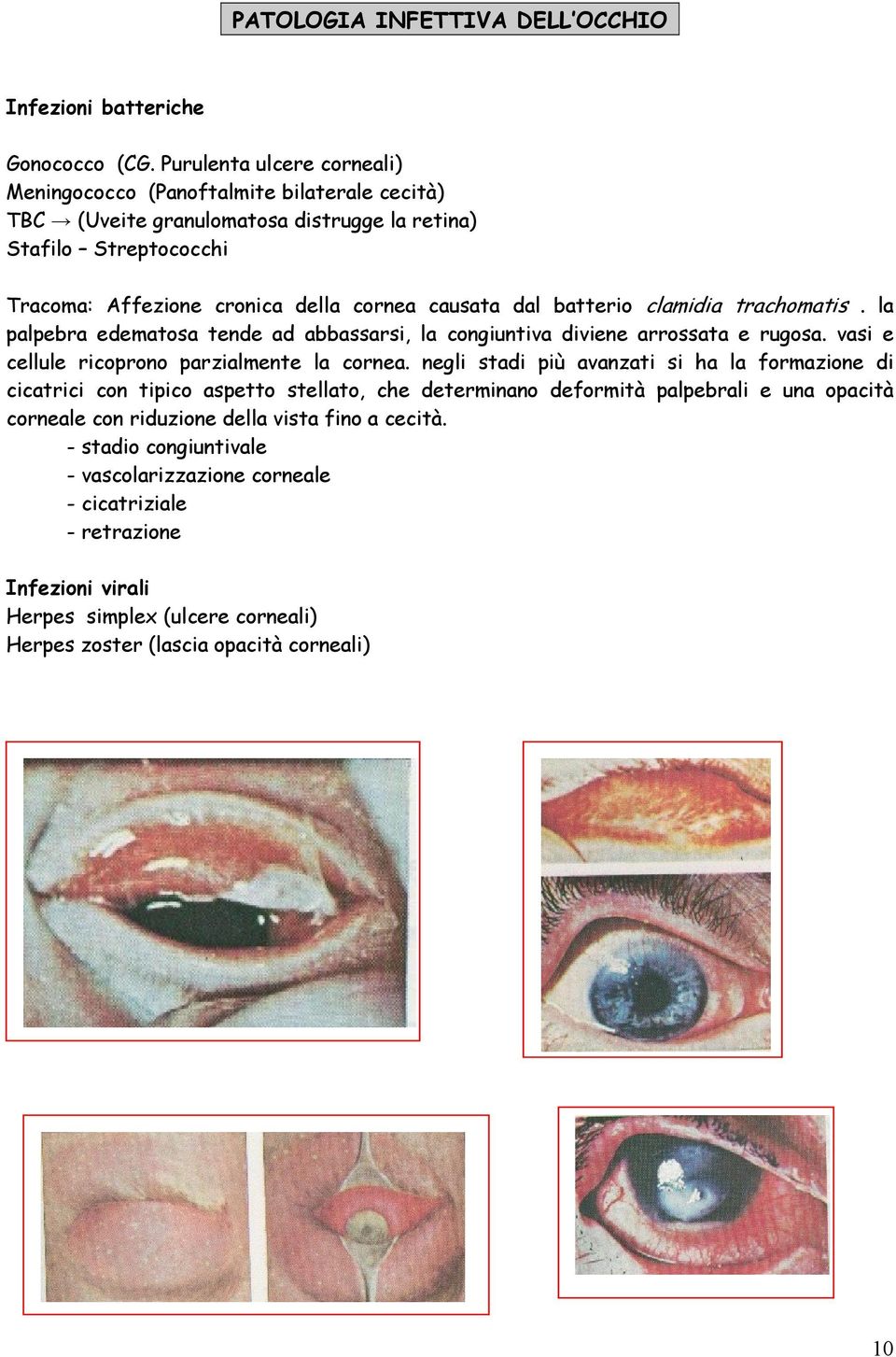 batterio clamidia trachomatis. la palpebra edematosa tende ad abbassarsi, la congiuntiva diviene arrossata e rugosa. vasi e cellule ricoprono parzialmente la cornea.