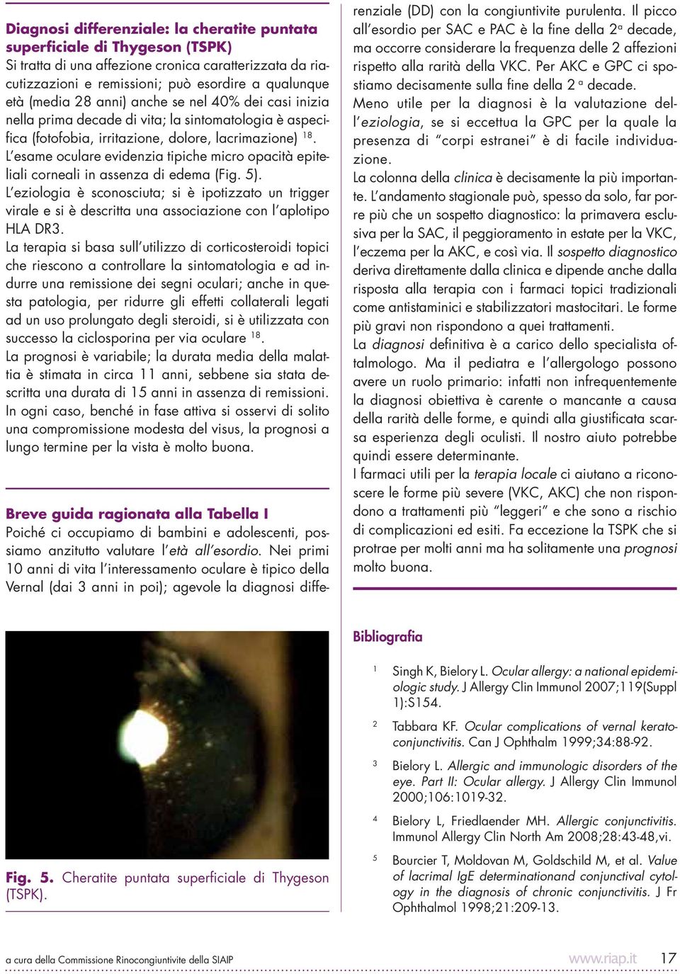 L esame oculare evidenzia tipiche micro opacità epiteliali corneali in assenza di edema (Fig. 5).