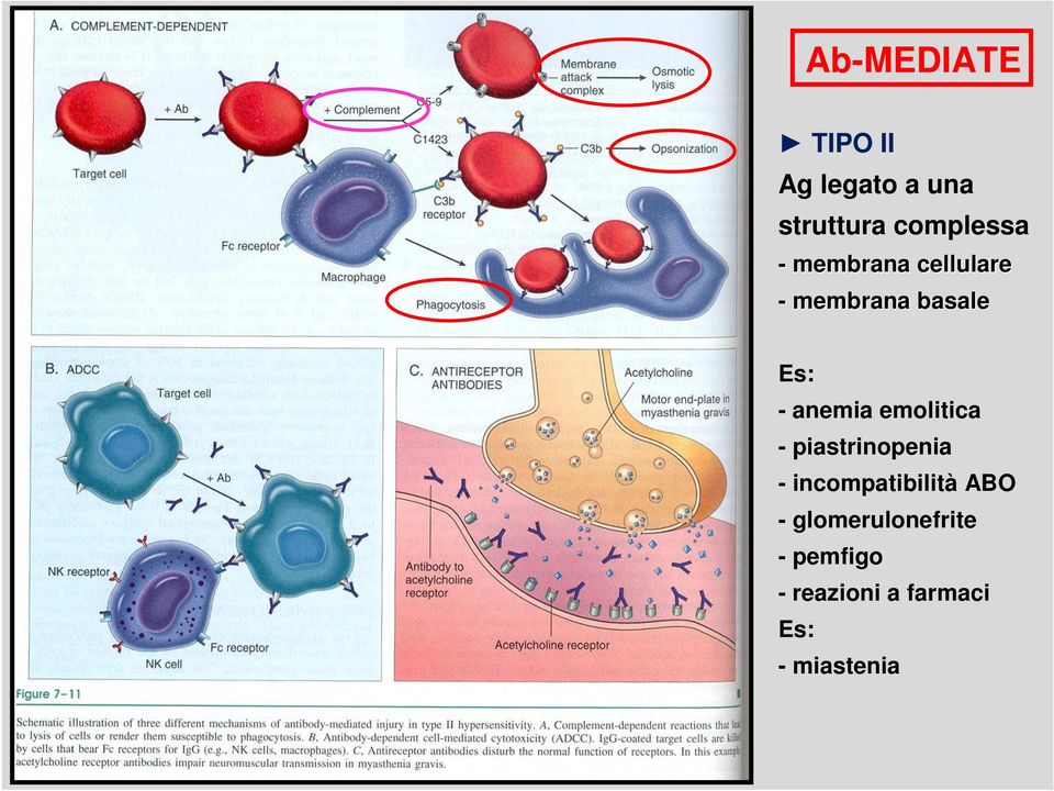 emolitica - piastrinopenia - incompatibilità ABO -