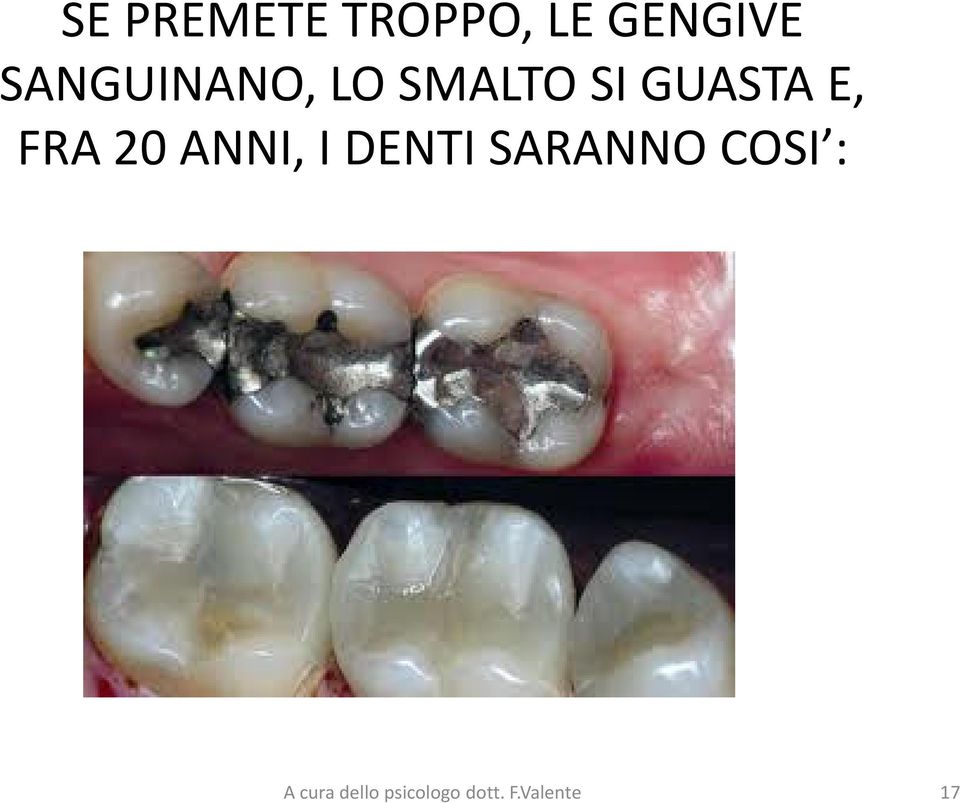 FRA 20 ANNI, I DENTI SARANNO COSI :