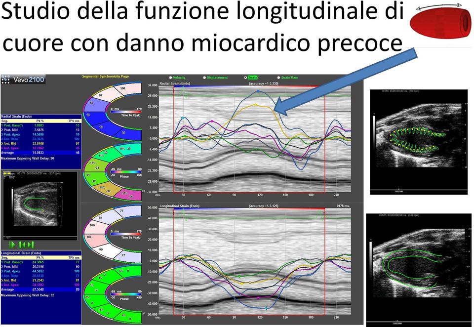 longitudinale di