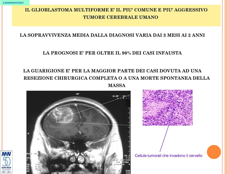 90% DEI CASI INFAUSTA LA GUARIGIONE E PER LA MAGGIOR PARTE DEI CASI DOVUTA AD UNA