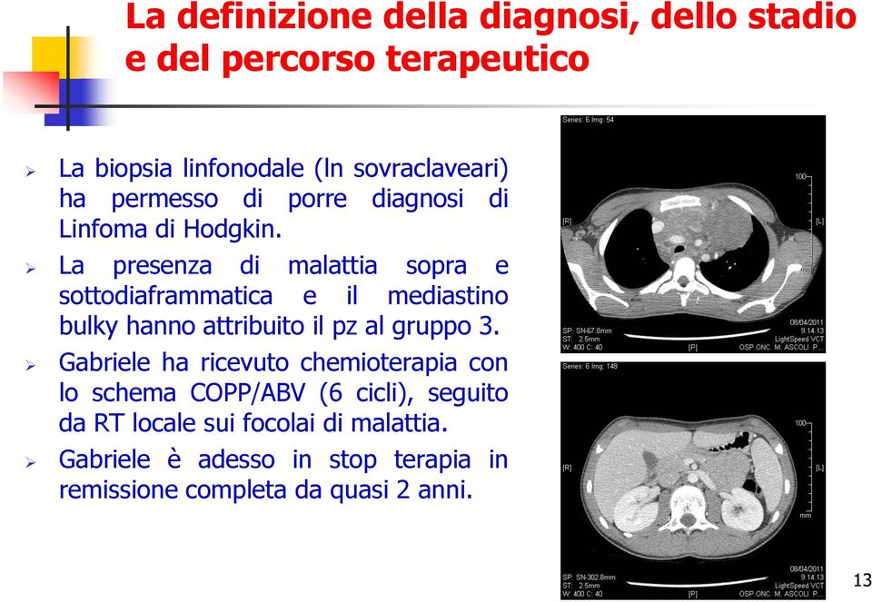 La presenza di malattia sopra e sottodiaframmatica e il mediastino bulky hanno attribuito il pz al gruppo 3.