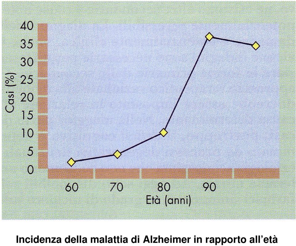 di Alzheimer