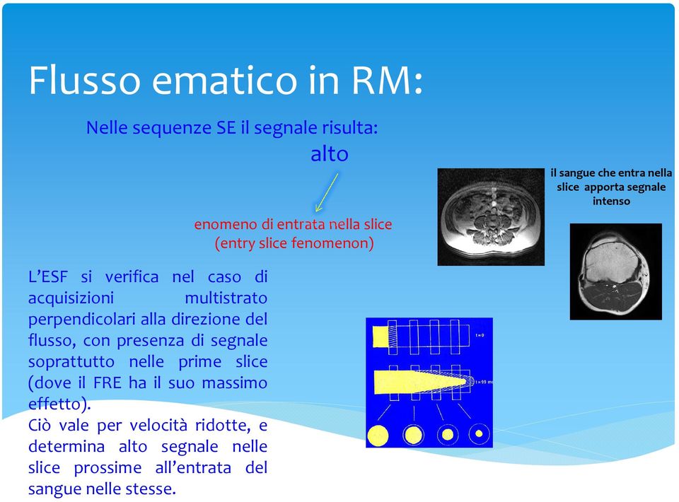 perpendicolari alla direzione del flusso, con presenza di segnale soprattutto nelle prime slice (dove il FRE ha il suo